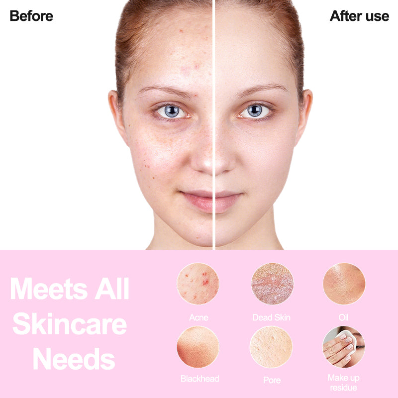 Silicone Face Brushes for Cleansing and Exfoliating Sonic Facial Scrubber Exfoliator Brush Facial Cleansing Brush